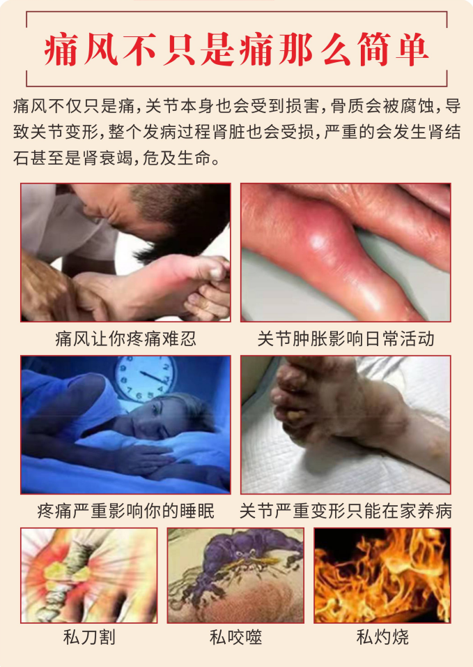 痛風(fēng)膏4.png