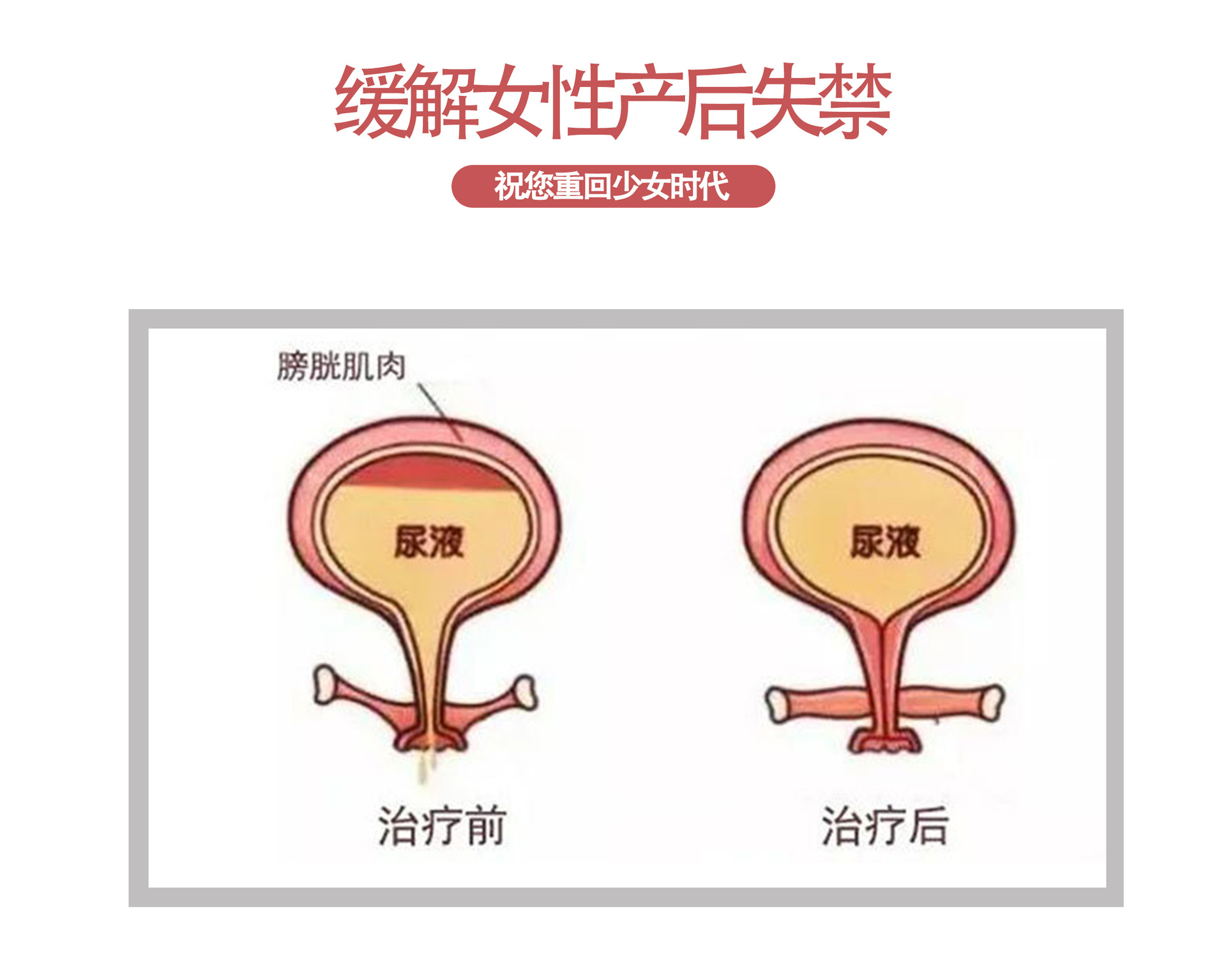 5-詳情圖.jpg
