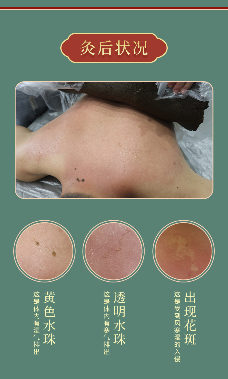 熱灸膏定制鏈接_10.jpg