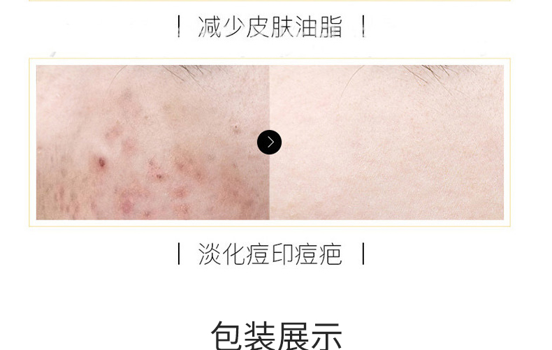 滋養(yǎng)柔順護(hù)發(fā)素4_07.jpg
