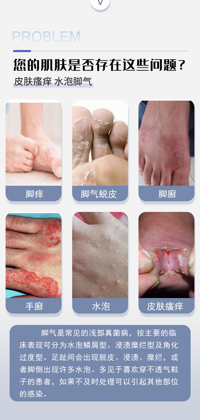 腳氣膏詳情_(kāi)03.jpg