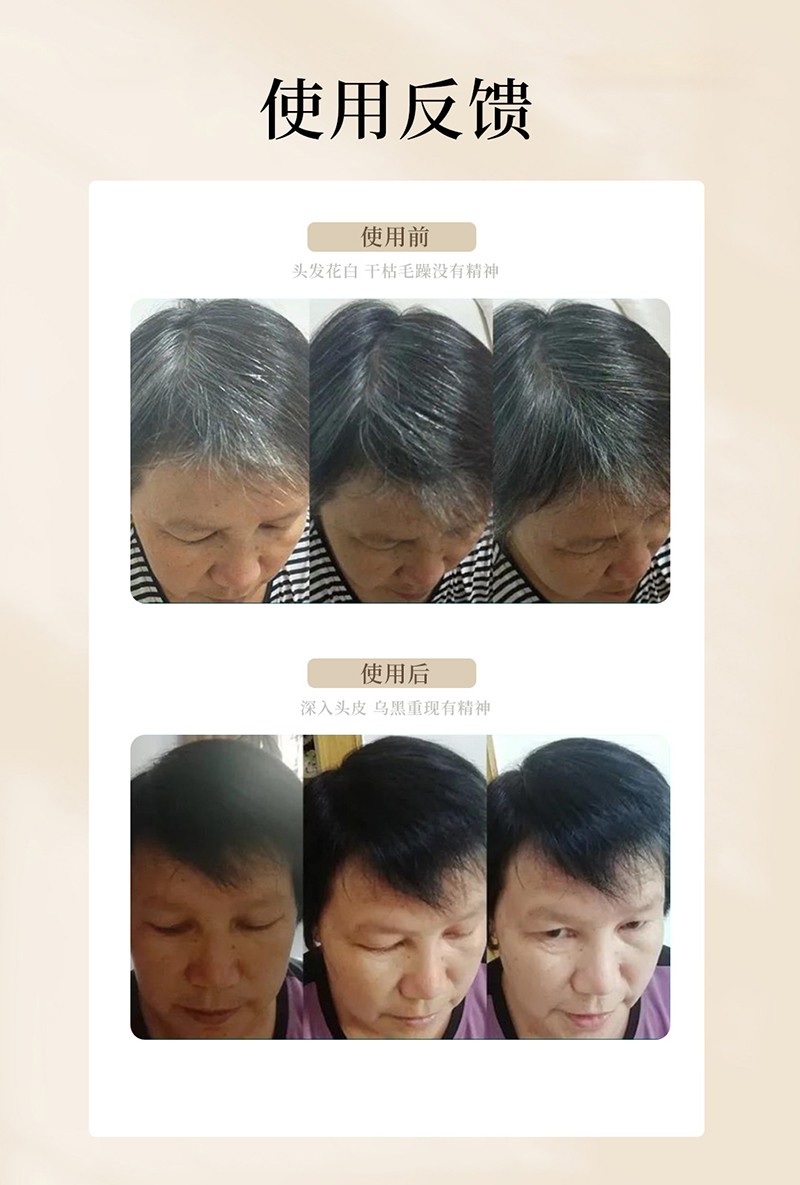 烏珠草本黑發(fā)保健液8.jpg